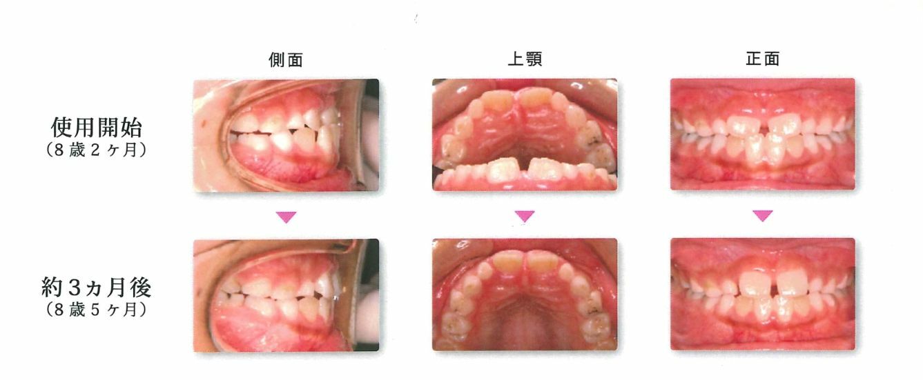 使用後